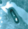 Listeria